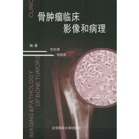 骨肿瘤临床影像和病理