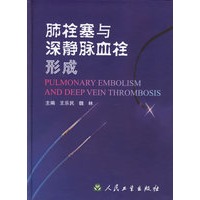 肺栓塞与深静脉血栓形成 精