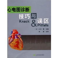 心电图诊断技巧与误区
