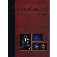 急性冠状动脉综合征