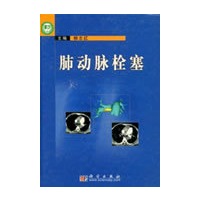 肺动脉栓塞